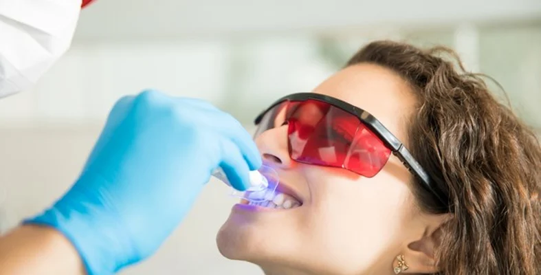 تبييض الأسنان بالليزر